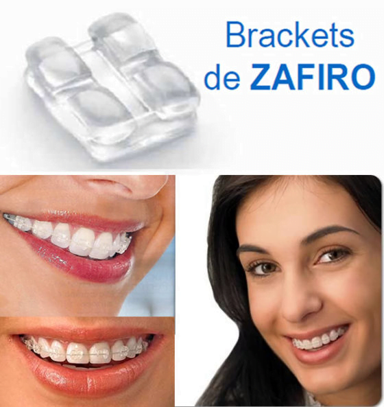 servicio de Ortodoncia en Villanueva de la Serena