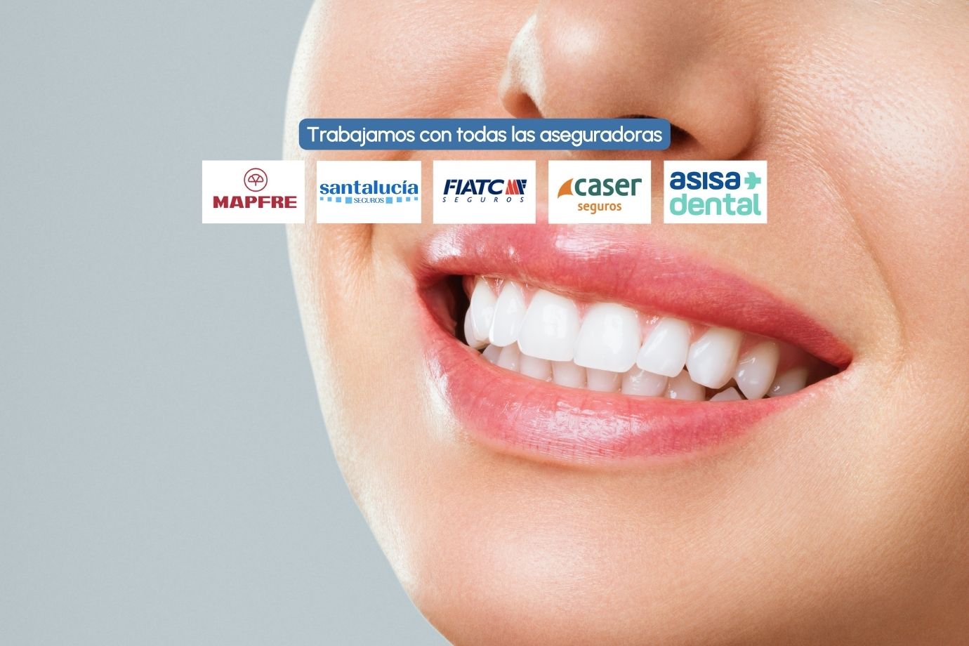 Trabajamos con tu seguro dental: Mapfre, Santa Lucía, Caser…